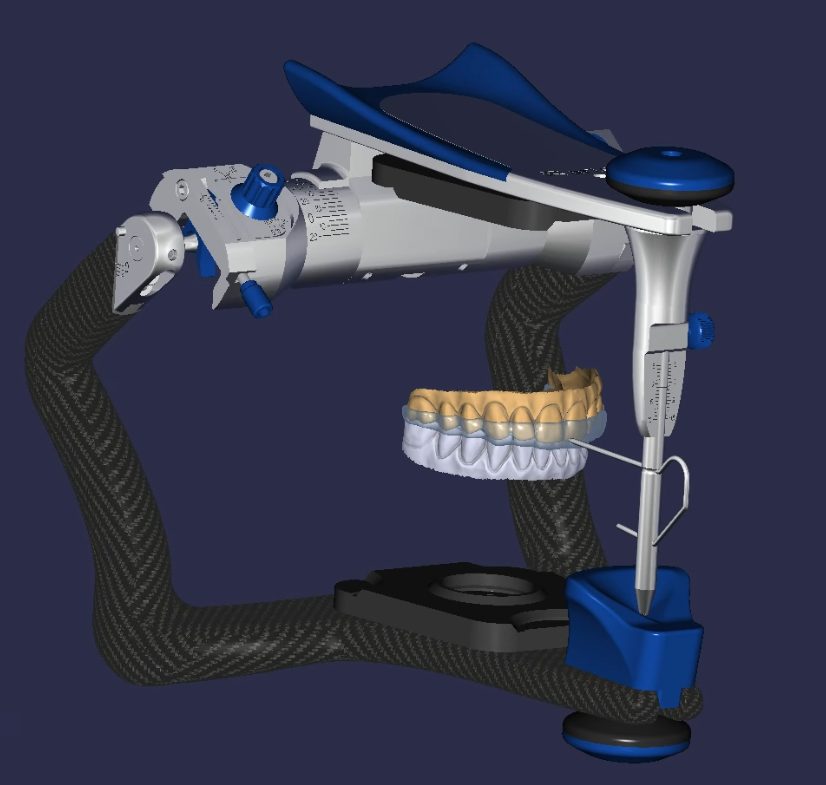 Digital design on a virtual articulator